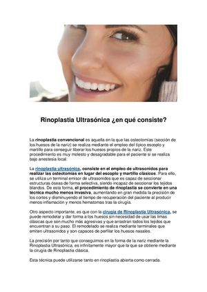 Rinoplastia Ultrasónica En Que Consiste