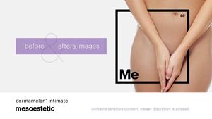 mesoestetic dermamelan intimate - Before & Afters