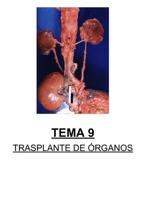 Tema 9 Transplante De ÓRganos