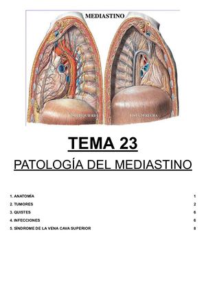Tema 23.- Patología Del Mediastino
