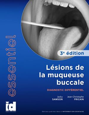 Diagnotic Differentiel 3e Edition - Preview