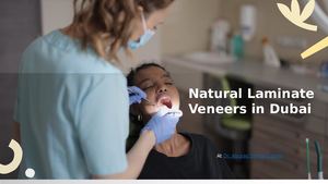 Natural Laminate Veneers