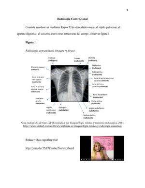 Actividad 2- Semiologia Radiologica