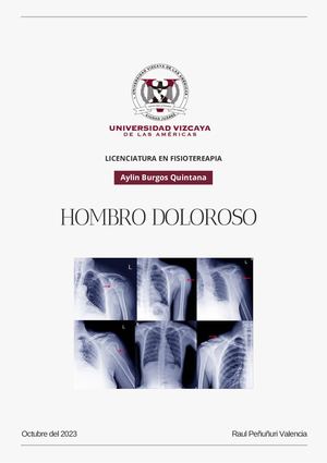 Revista Hombro Doloroso