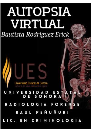 Autopsia Virtual bautista rodriguez erick radiologia forense