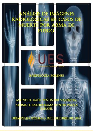 Rrevista Radiología Forense, Casos De Heridas Por Arma De Fuego