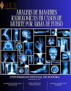 ANALISIS DE IMAGENES RADIOLOGICAS EN CASOS DE MUERTE POR ARMA DE FUEGO (RADIOLOGÍA FORENSE)