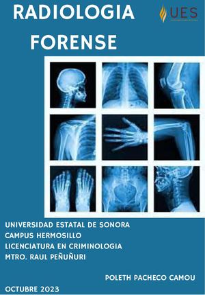 Radiologia Forense