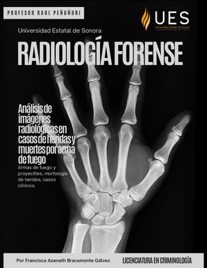 Radiología forense: Análisis de imágenes radiológicas en casos de heridas o muertes por arma de fuego.