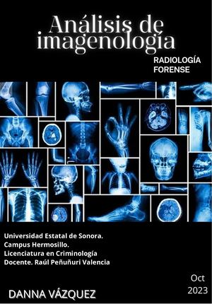 Analisis imagenología