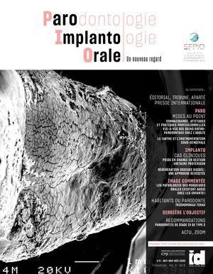 PIO 4 - 2023 Preview