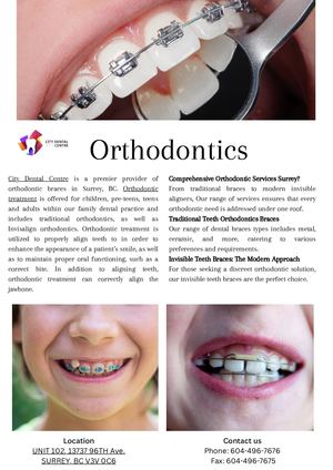 Orthodontics Services in Surrey
