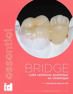 Essentiel - Bridge Cantilever - Preview