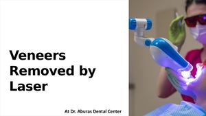 Veneers Removed By Laser