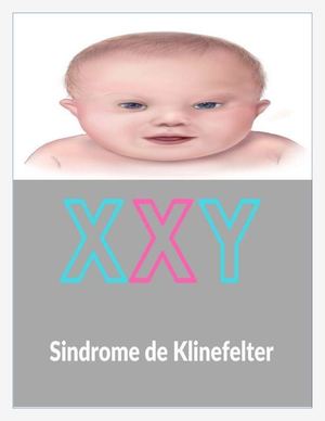 Revista Del Sindrome De Klinefelter