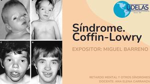 Síndrome Coffin Lowry