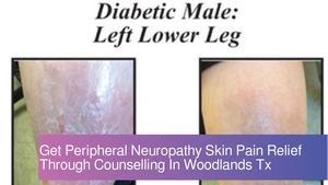 Get Peripheral Neuropathy Skin Pain Relief Through Counselling In Woodlands Tx