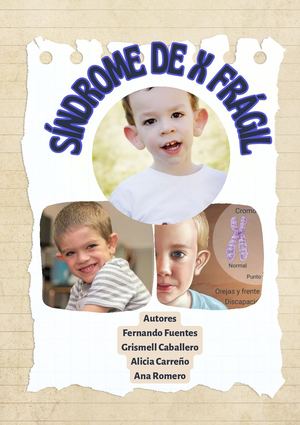 Síndrome De X Fragil
