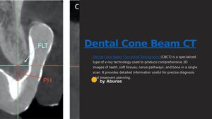 Calaméo - Dental Cone Beam Ct