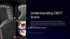 Calaméo - Cbct Scan For Dental Implant