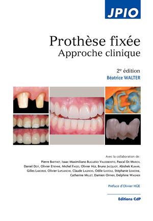 JPIO Prothèse Fixée