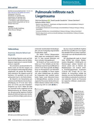 11 Pulmonale Infiltrate Nach Liegetrauma