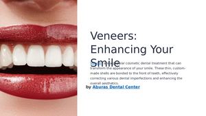 Veneers