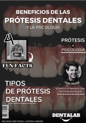 Beneficios De Las Prótesis dentales y la psicología