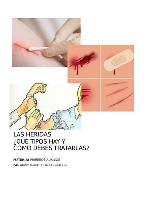 Las Heridas: ¿Qué Tipos Hay Y Cómo Debes Tratarlas?