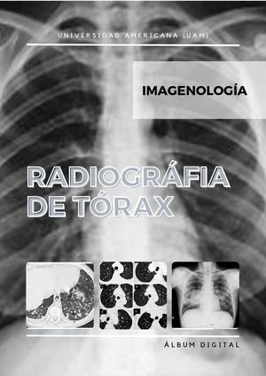 Póster De Radiogría De Torax