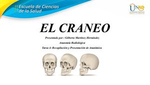 El Craneo