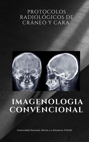 Tarea 4 Protocolos Radiológicos De Cráneo Y Cara (1)