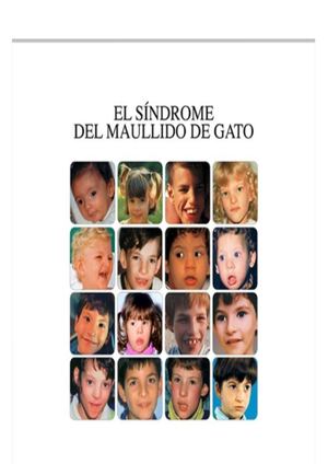 Revista síndrome maullido de gato