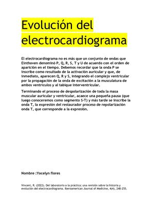 electrocardiograma