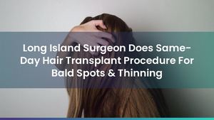 Long Island Surgeon Does Same-Day Hair Transplant Procedure For Bald Spots & Thinning