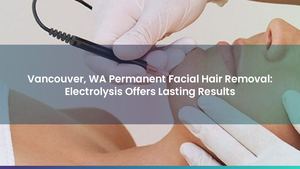 Vancouver, WA Permanent Facial Hair Removal: Electrolysis Offers Lasting Results