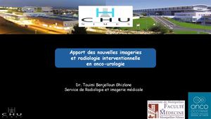 RR Urologie 2025 : Apport des nouvelles imageries et radiologie interventionnelle en onco-urologie - Ghizlane Touimi Benjelloun