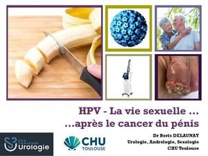 RR oncosexo  La Vie Sexuelle Après Le Cancer Du Penis Boris Delaunay