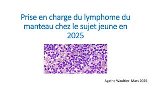 RR Lymphome EST : Prise En Charge Du Lymphome Du Manteau Chez Le Sujet Jeune En 2025 - Agathe Waultier