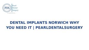 Dental Implants Norwich Why You Need It Pearl Dental Surgery