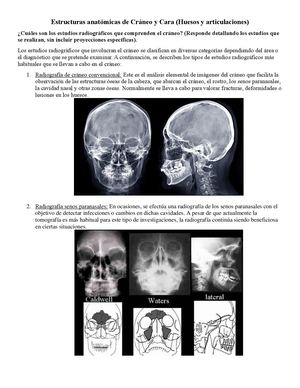 Estructura Anatomica De Craneo Y Cara