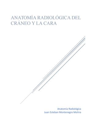 Anatomia Radiologica De Craneo Y Cara Juan Esteban Montenegro