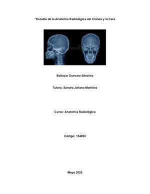 Estudio De La Anatomía Radiológica Del Cráneo Y La Cara Ca Lameo Balta