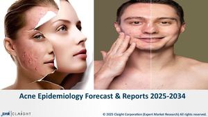Acne Epidemiology Forecast