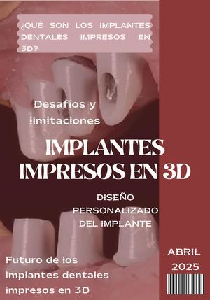 Implantes Impresos En 3d MARIA FERNADA MURCIA