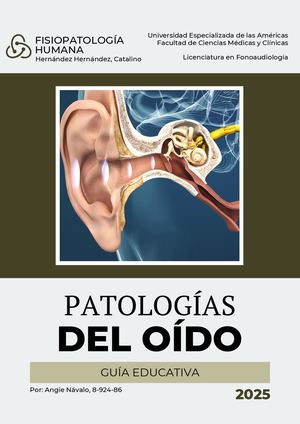 Patologías Del Oído Angie Návalo