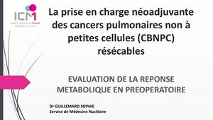 RR Thorax 25 : Evaluation de la réponse métabolique en préopératoire - Sophie Guillemard