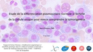 RR Myélome Est 25 : Etude de la différenciation plasmocytaire - Sara OVEJERO