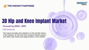 3d Hip And Knee Implant Market