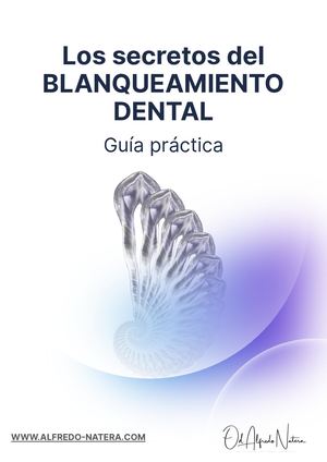 Ebook Blanqueamiento